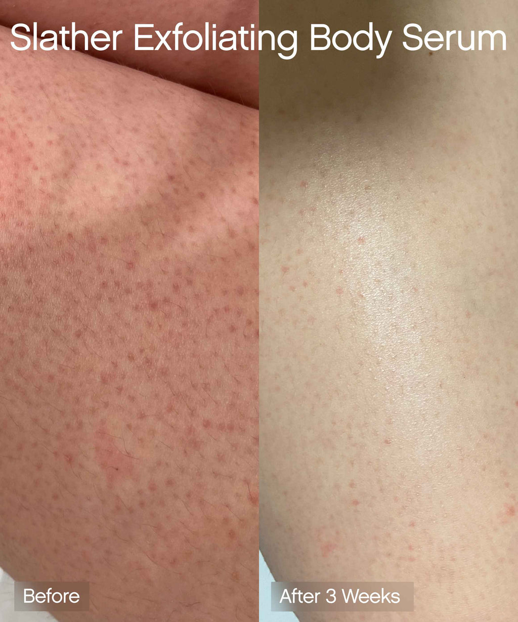 Body MVPs